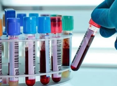 WhatsApp Image 2024-04-18 at 13.17.25